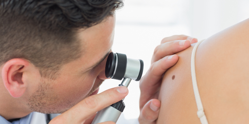 Mole dermoscopy in Zadar