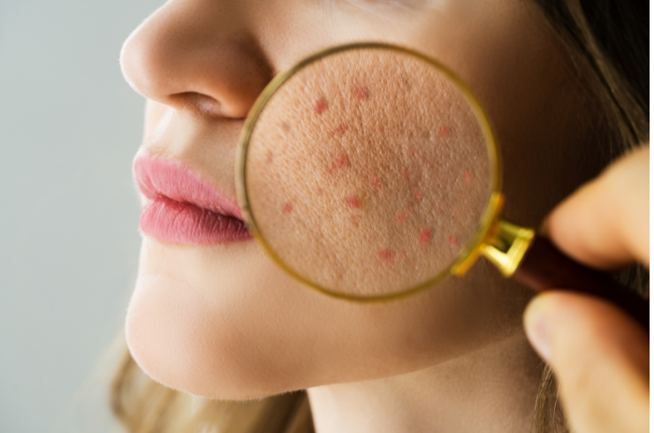 Dermatological examination at Poliklinika Kranjčec