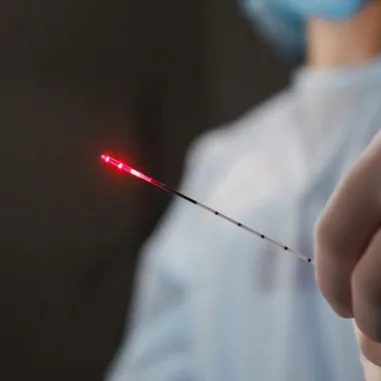 A BioLitec Leonardo laser procedure